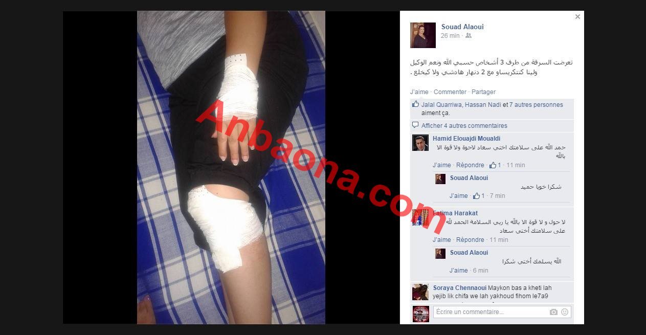 الفنانة المغربية سعاد العلوي تتعرض للسرقة والضرب من قبل مجهولين
