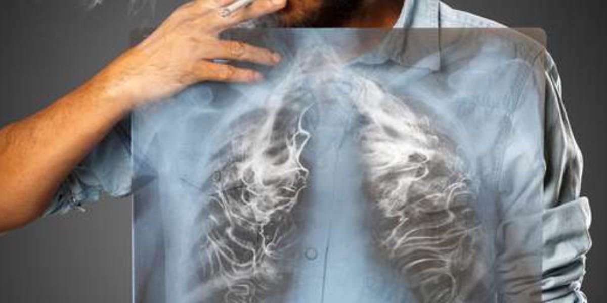 أطباء يؤكدون ان البدائل الخالية من الدخان تحد من المخاطر المرتبطة بالتدخين